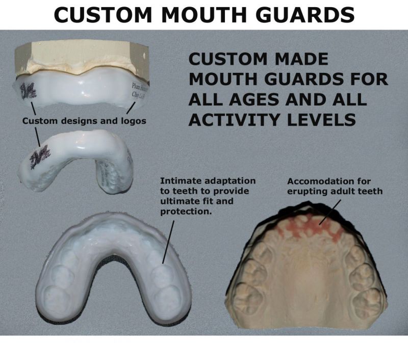 Adams Mouthguard An Unbiased Look at Key Features and Benefits