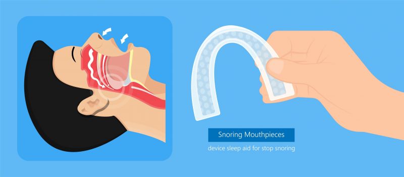 Adams Mouthguard An Unbiased Look at Key Features and Benefits