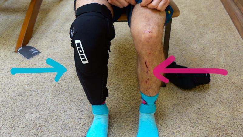 Are Basketball Knee Pads Really Necessary. 15 Ways They Improve Your Game