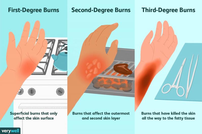 Are Body Glide Foot and Anti Blister Balms Effective for Runners This Year