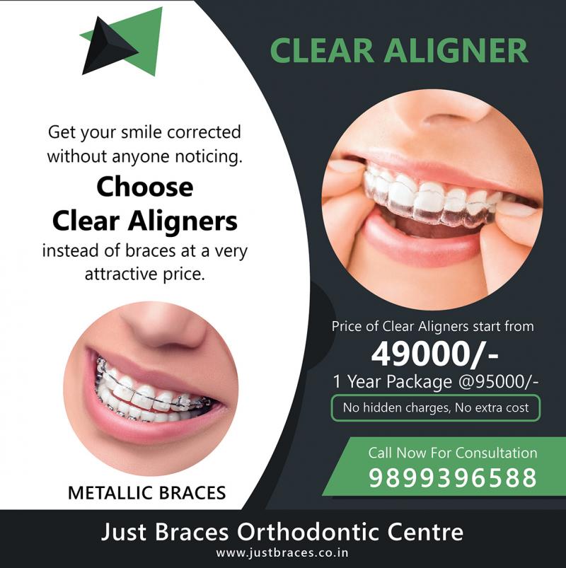 Are Clear Aligners Right for You This Year: Answers to Top Questions About Invisible Orthodontics