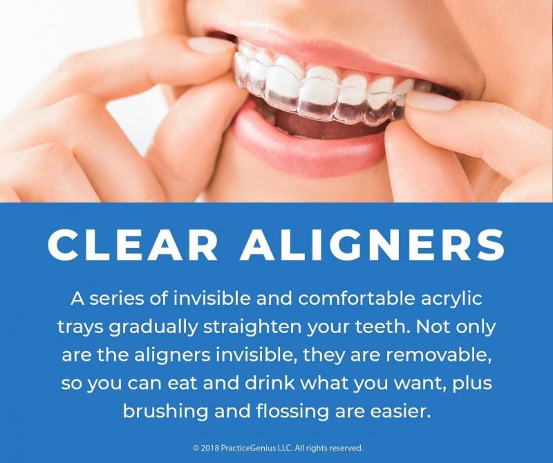 Are Clear Aligners Right for You This Year: Answers to Top Questions About Invisible Orthodontics
