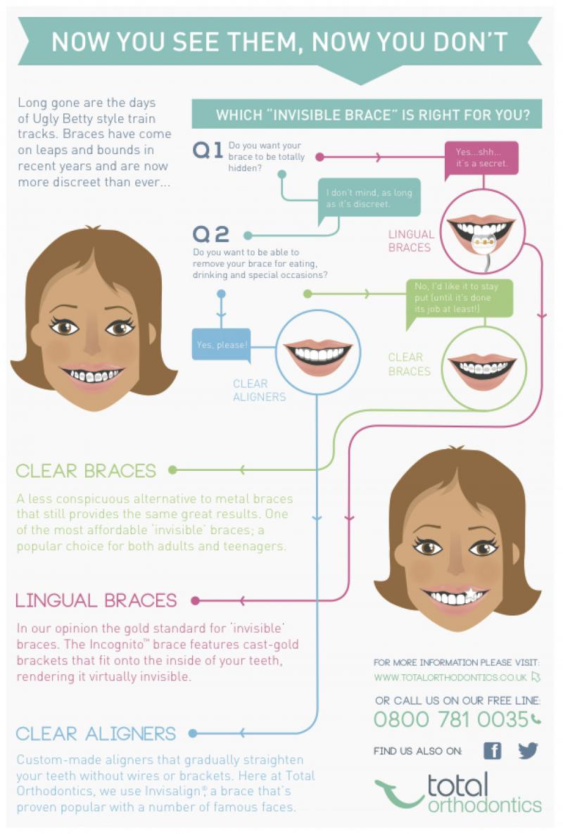 Are Clear Aligners Right for You This Year: Answers to Top Questions About Invisible Orthodontics