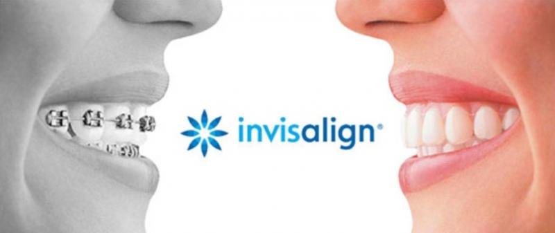 Are Clear Aligners Right for You This Year: Answers to Top Questions About Invisible Orthodontics