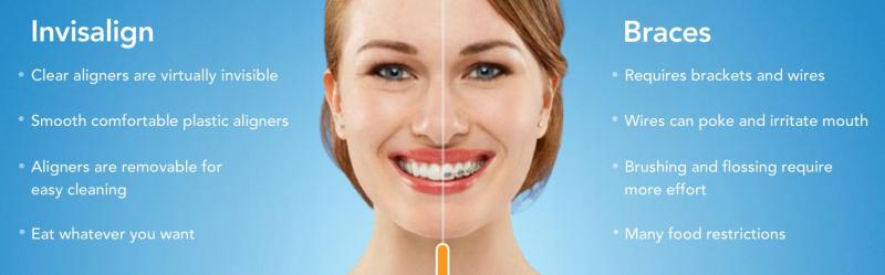 Are Clear Aligners Right for You This Year: Answers to Top Questions About Invisible Orthodontics