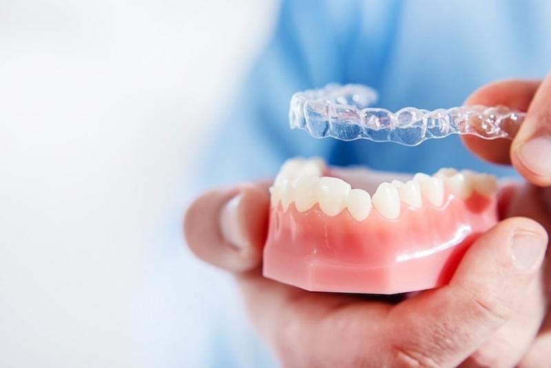 Are Clear Aligners Right for You This Year: Answers to Top Questions About Invisible Orthodontics