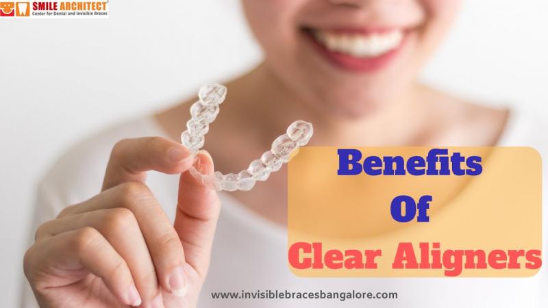 Are Clear Aligners Right for You This Year: Answers to Top Questions About Invisible Orthodontics