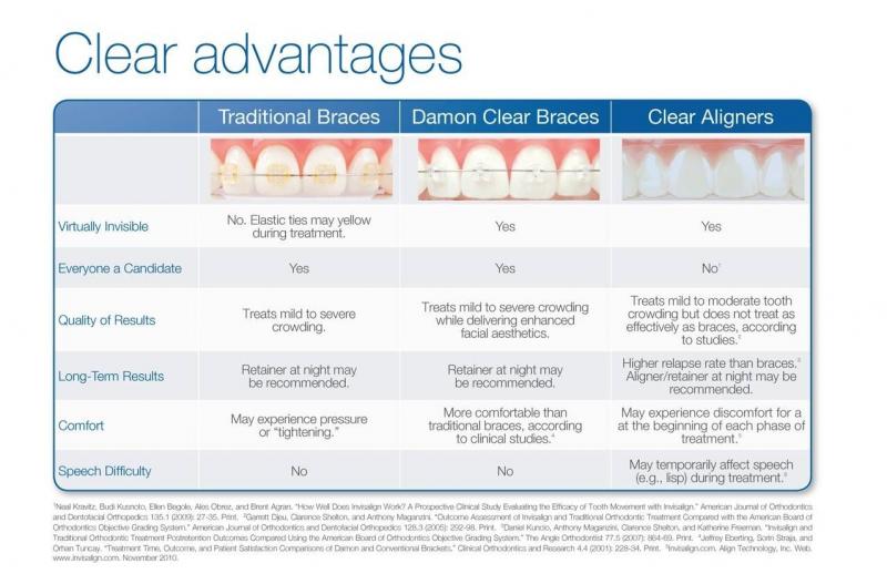 Are Clear Aligners Right for You This Year: Answers to Top Questions About Invisible Orthodontics