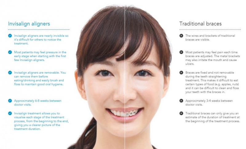 Are Clear Aligners Right for You This Year: Answers to Top Questions About Invisible Orthodontics