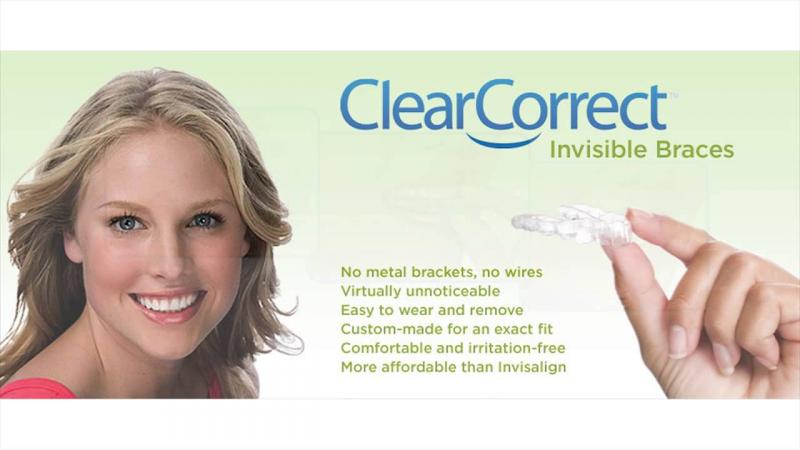 Are Clear Aligners Right for You This Year: Answers to Top Questions About Invisible Orthodontics