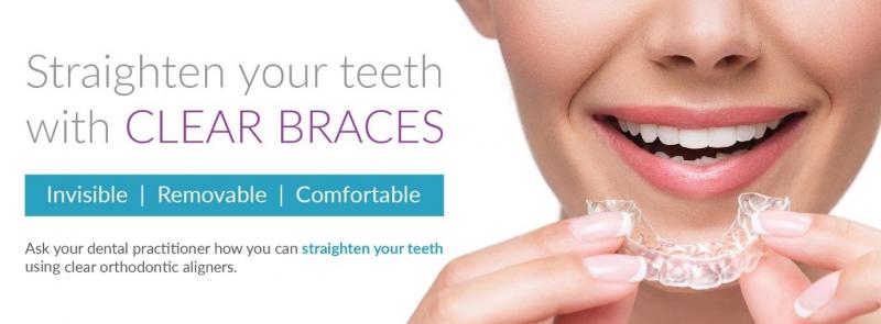Are Clear Aligners Right for You This Year: Answers to Top Questions About Invisible Orthodontics