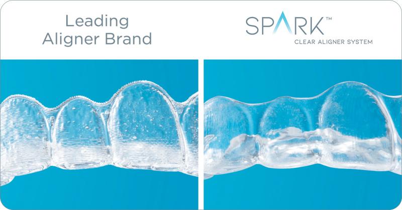 Are Clear Aligners Right for You This Year: Answers to Top Questions About Invisible Orthodontics