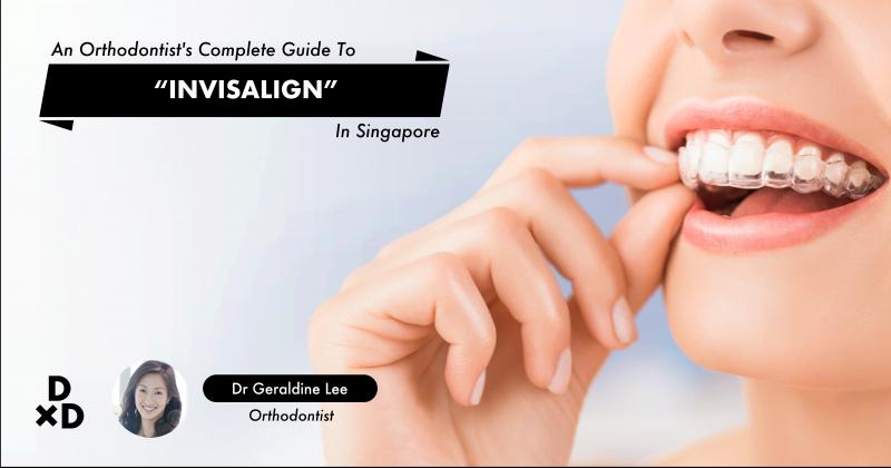 Are Clear Aligners Right for You This Year: Answers to Top Questions About Invisible Orthodontics