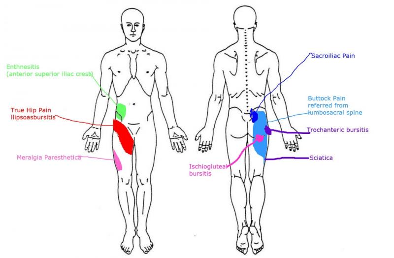 Are You Suffering From Hip Flexor Pain. Try These Compression Shorts For Fast Relief