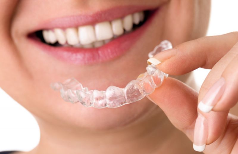 Best Braces Mouthguards for Adults  Teens In 2023