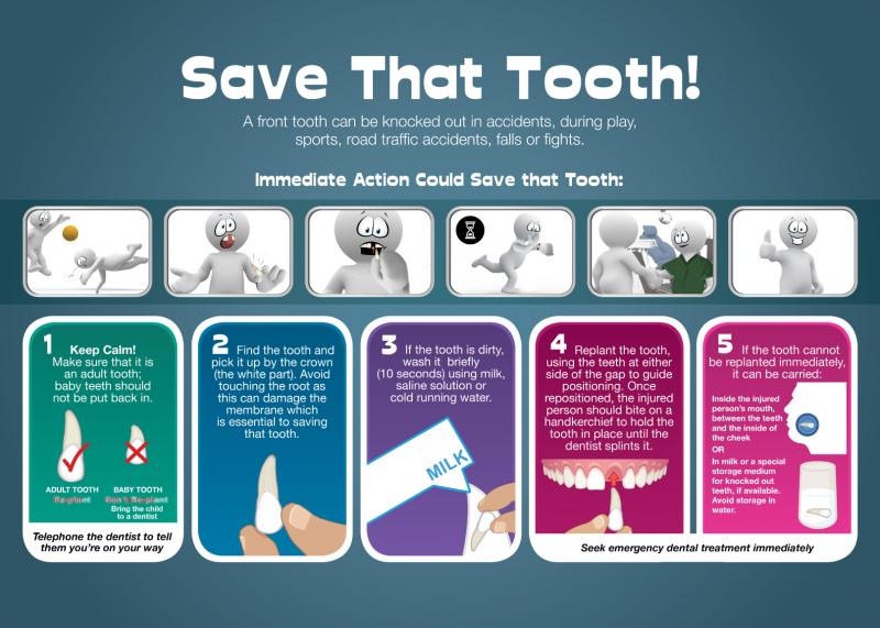 Best Mouthguards to Prevent Injuries: How to Find the Perfect Fit for You