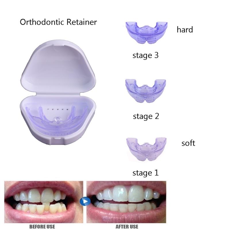 Braces Mouthguards With Straps: 15 Shocking Facts You Must Know in 2023