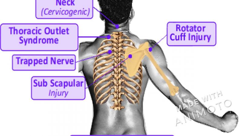 Can a Copper Shoulder Compression Sleeve Relieve Your Shoulder Pain: An Expert Guide on the Benefits of Using a Copper Shoulder Sleeve