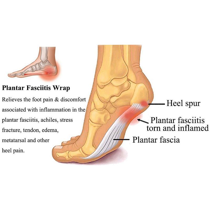 Can a Plantar Fasciitis Sleeve Relieve Your Foot Pain. McDavid Offers Solutions