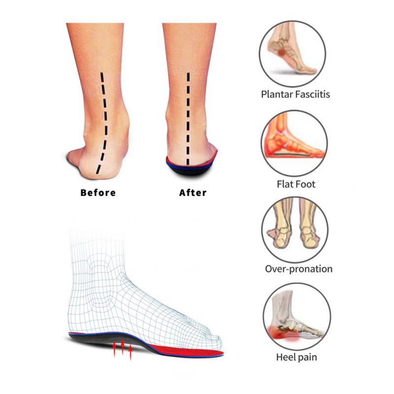 Can a Plantar Fasciitis Sleeve Relieve Your Foot Pain. McDavid Offers Solutions
