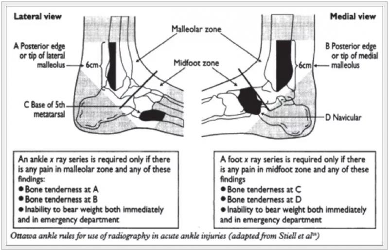 Can Ankle Injury Recovery Really Be Accelerated. Learn How Ankle Wraps Get You Back On Your Feet