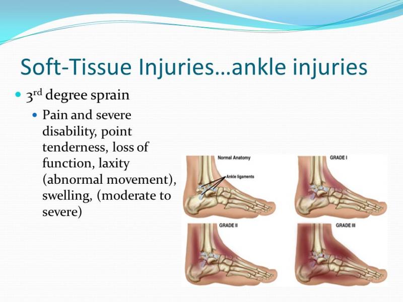 Can Ankle Injury Recovery Really Be Accelerated. Learn How Ankle Wraps Get You Back On Your Feet