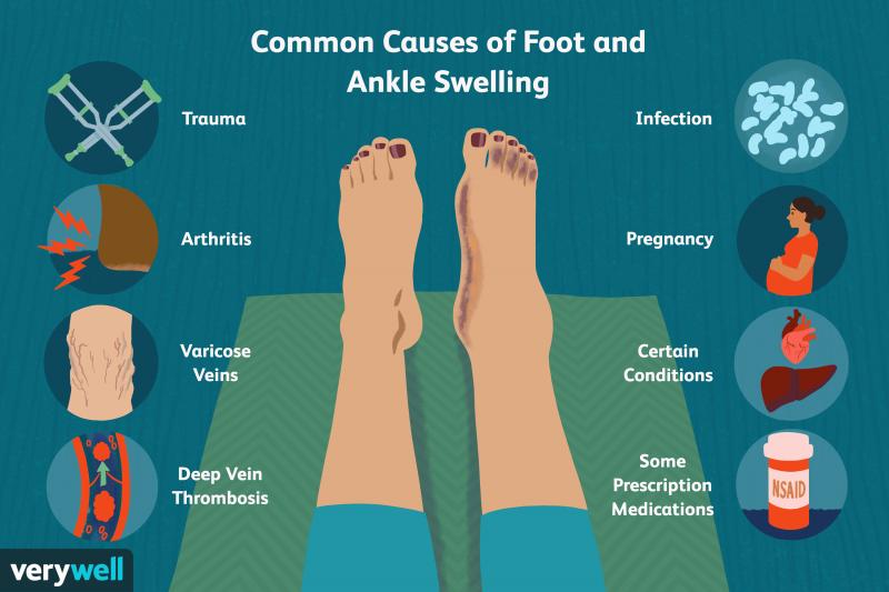 Can Ankle Injury Recovery Really Be Accelerated. Learn How Ankle Wraps Get You Back On Your Feet