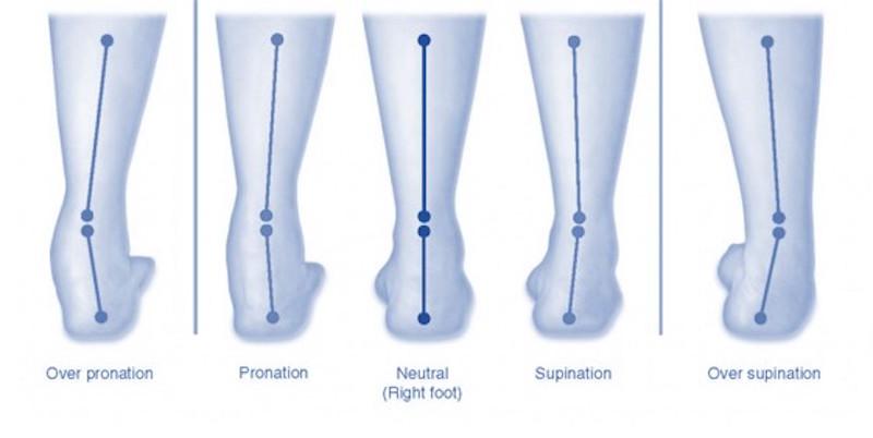 Can Superfeet Insoles Really Relieve Your Foot Pain: 11 Tips To Get The Most Out Of Orthotics And Give Your Feet A Fresh Start