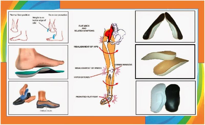 Can Superfeet Insoles Really Relieve Your Foot Pain: 11 Tips To Get The Most Out Of Orthotics And Give Your Feet A Fresh Start