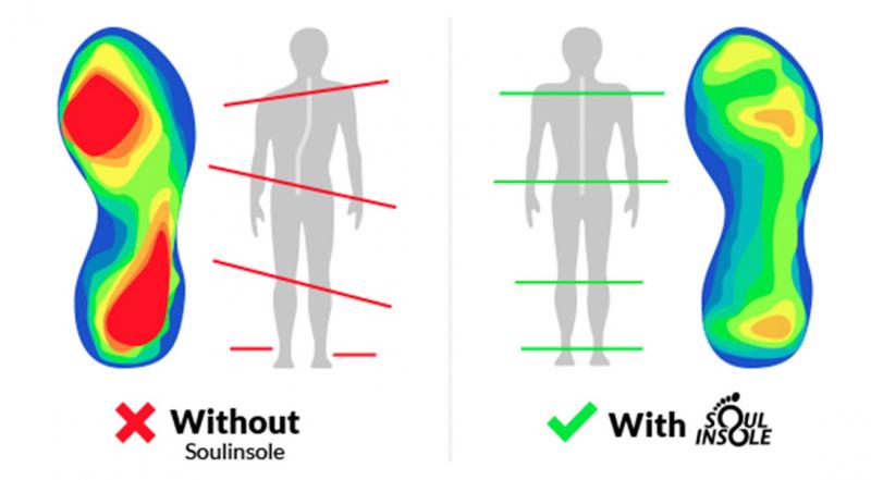 Can Superfeet Insoles Really Relieve Your Foot Pain: 11 Tips To Get The Most Out Of Orthotics And Give Your Feet A Fresh Start