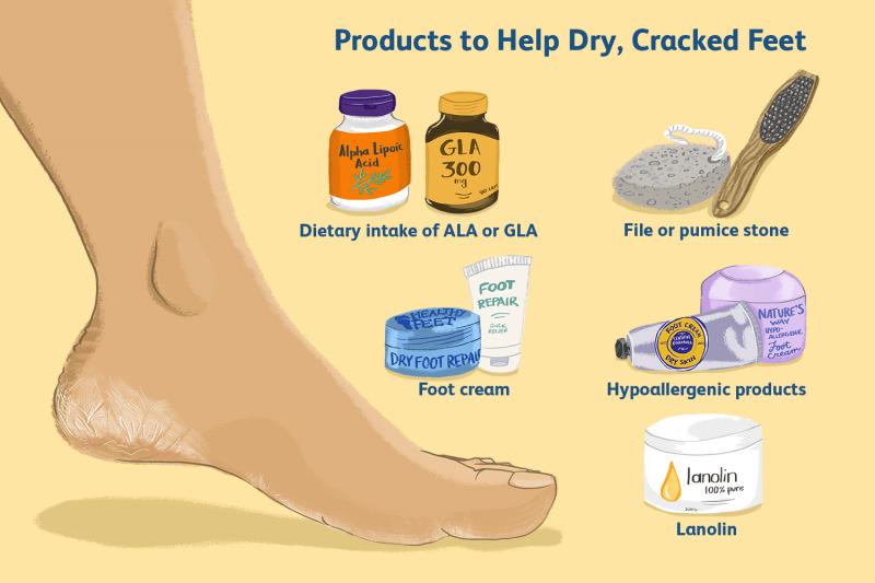 Can Superfeet Insoles Really Relieve Your Foot Pain: 11 Tips To Get The Most Out Of Orthotics And Give Your Feet A Fresh Start