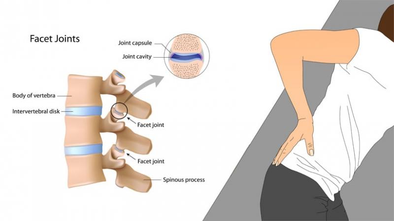 Can Wearing A Copper Fit Elbow Sleeve Really Relieve Your Joint Pain. 15 Life-Changing Facts