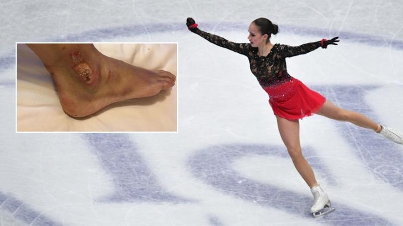 Can You Master These 15 Figure Skating Moves: Captivate Audiences With Grace On The Ice