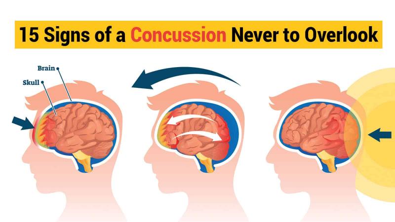 Could Lacrosse Cause Concussions. The Shocking Truth About Brain Injuries in Sports