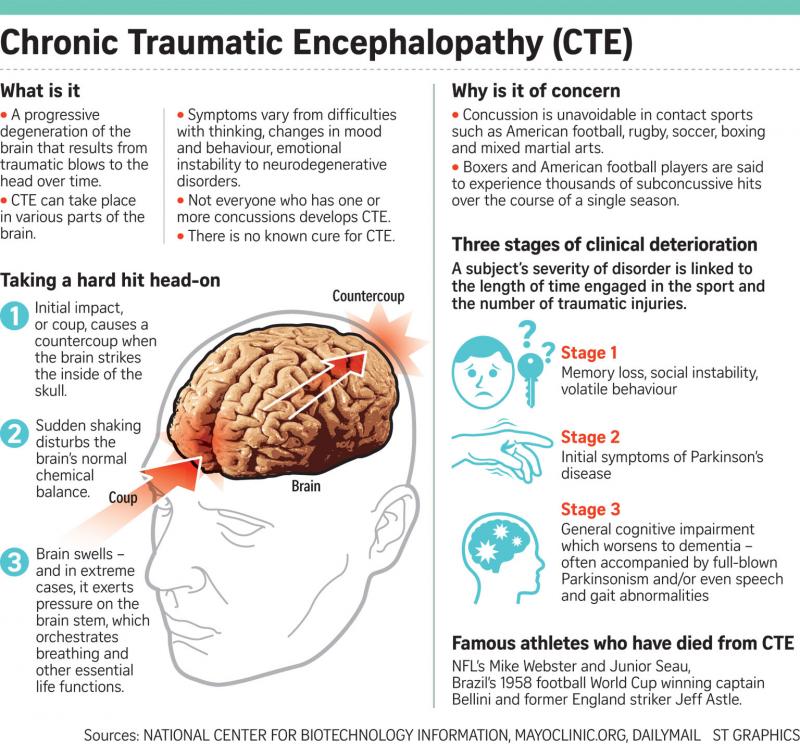 Could Lacrosse Cause Concussions. The Shocking Truth About Brain Injuries in Sports