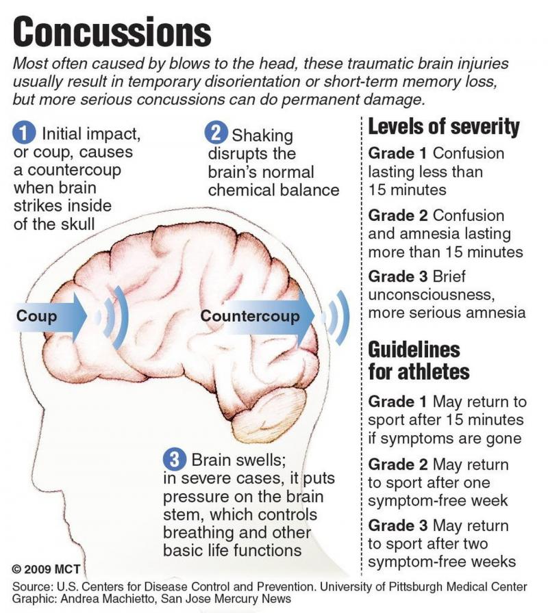Could Lacrosse Cause Concussions. The Shocking Truth About Brain Injuries in Sports