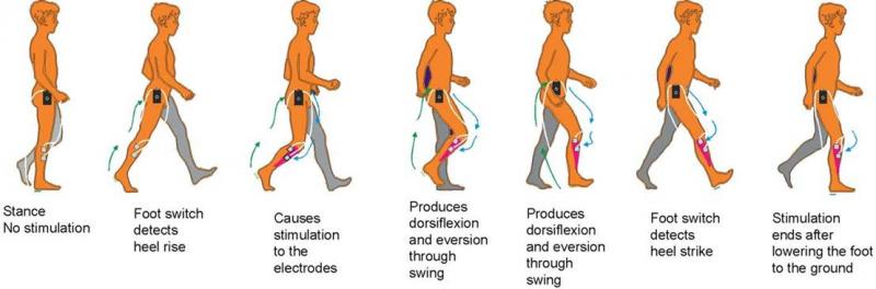 Could This Simple Device Improve Your Balance and Walking. The "Gait Draw" Explained