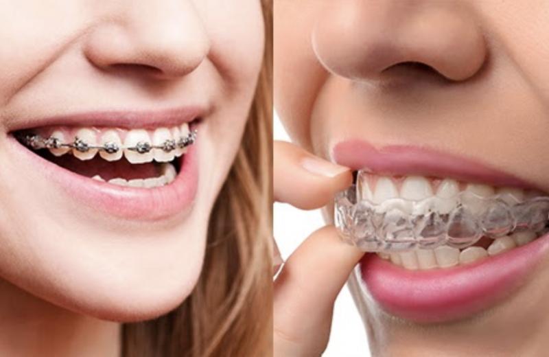 Curious About Shock Doctor Products. Find Out Their Best Mouthguards, Braces, And Shoulder Braces Here