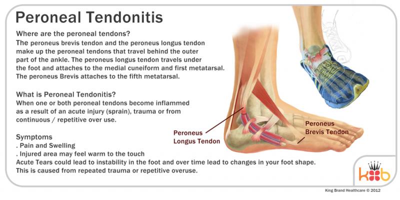 Do You Suffer From Achilles Tendon Pain. Check Out These Top Copper-Infused Ankle Supports