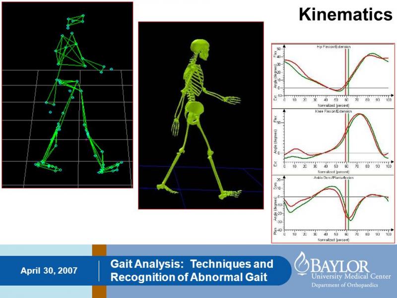 Does Your Team Have the Best Gait Lacrosse Gear This Year. :15 Ways to Improve Your Lacrosse Equipment With Gait