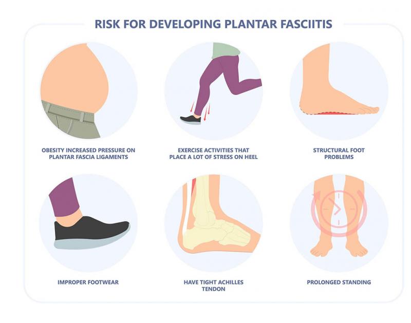 Engaging Interrogatory with Colon: Are These 7 Sof Sole Insoles the Best for Plantar Fasciitis Relief This Year. This Review Has the Fascinating Answer