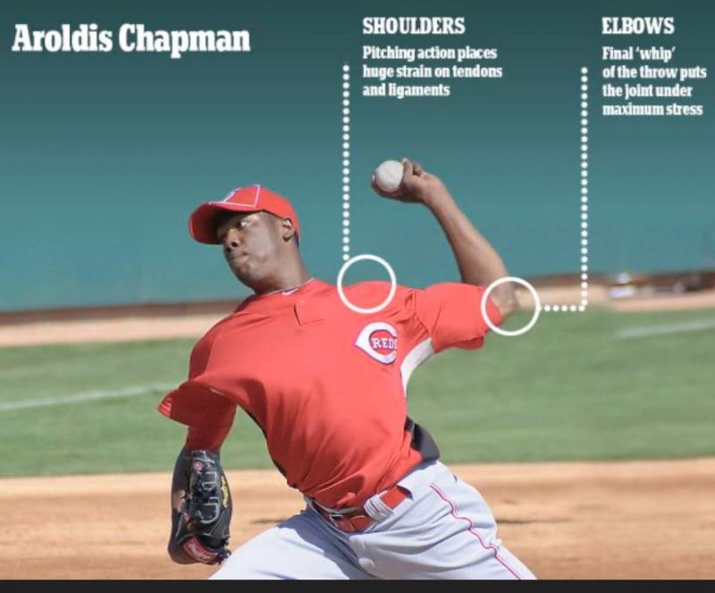 Essential Throwing Aids for Pitchers: Discover the Top Baseball Training Tools to Boost Velocity and Control