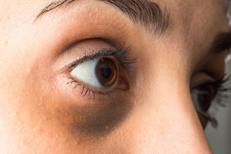 Eye Black for Athletes: The Secret to Eliminating Glare & Improving Focus
