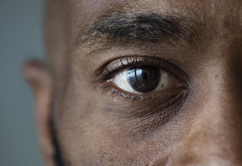 Eye Black for Athletes: The Secret to Eliminating Glare & Improving Focus