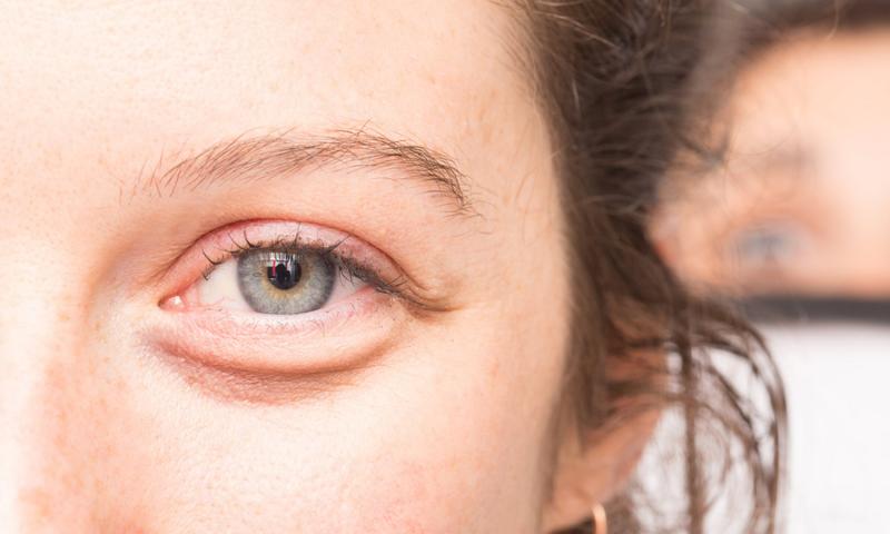 Eye Black for Athletes: The Secret to Eliminating Glare & Improving Focus
