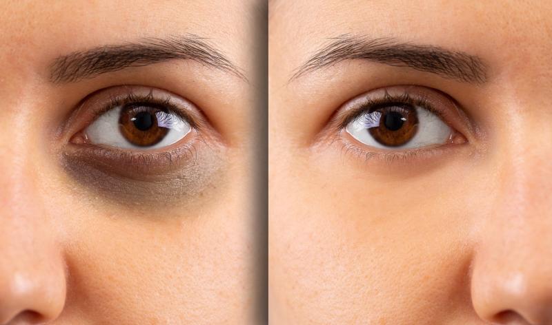 Eye Black for Athletes: The Secret to Eliminating Glare & Improving Focus