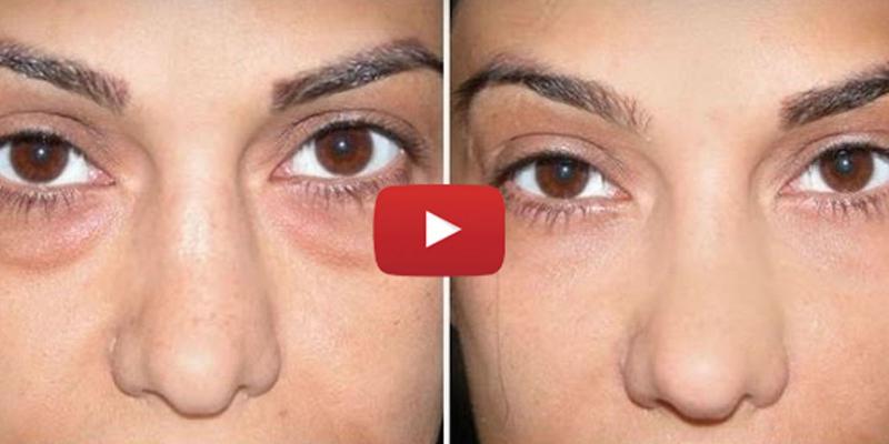 Eye Black for Athletes: The Secret to Eliminating Glare & Improving Focus