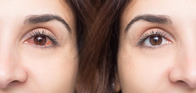 Eye Black for Athletes: The Secret to Eliminating Glare & Improving Focus