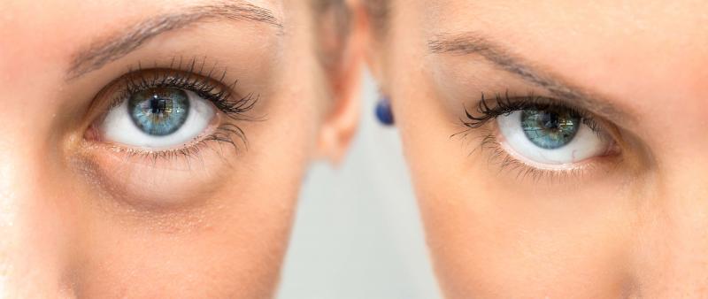 Eye Black for Athletes: The Secret to Eliminating Glare & Improving Focus