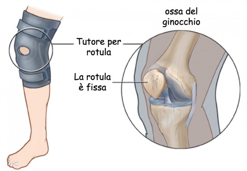 Feel Stable After Knee Injury. Try These Braces